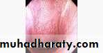 pharynx