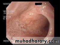 pharynx