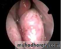 pharynx