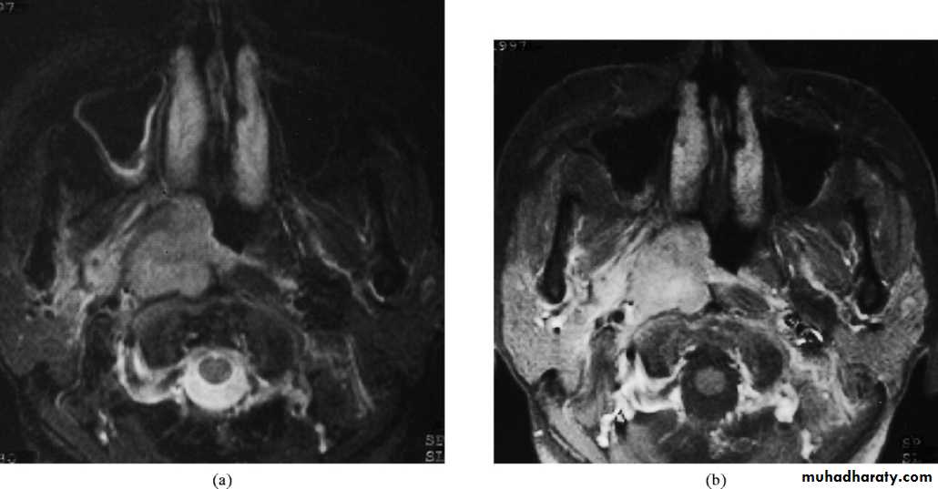 pharynx