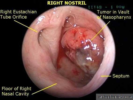 pharynx