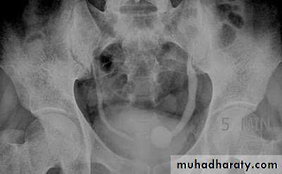urinary tract imaging(films)