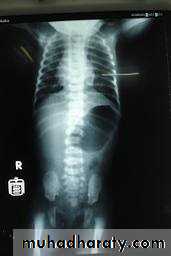 urinary tract imaging(films)