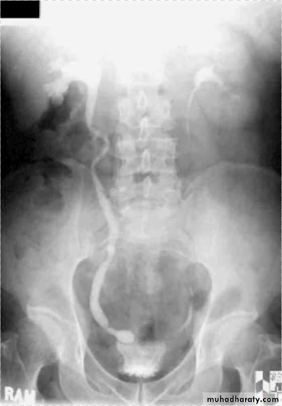 urinary tract imaging(films)