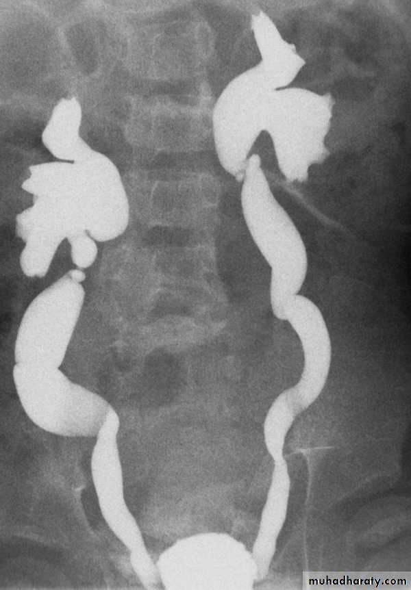 urinary tract imaging(films)