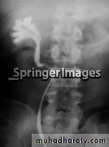 urinary tract imaging(films)
