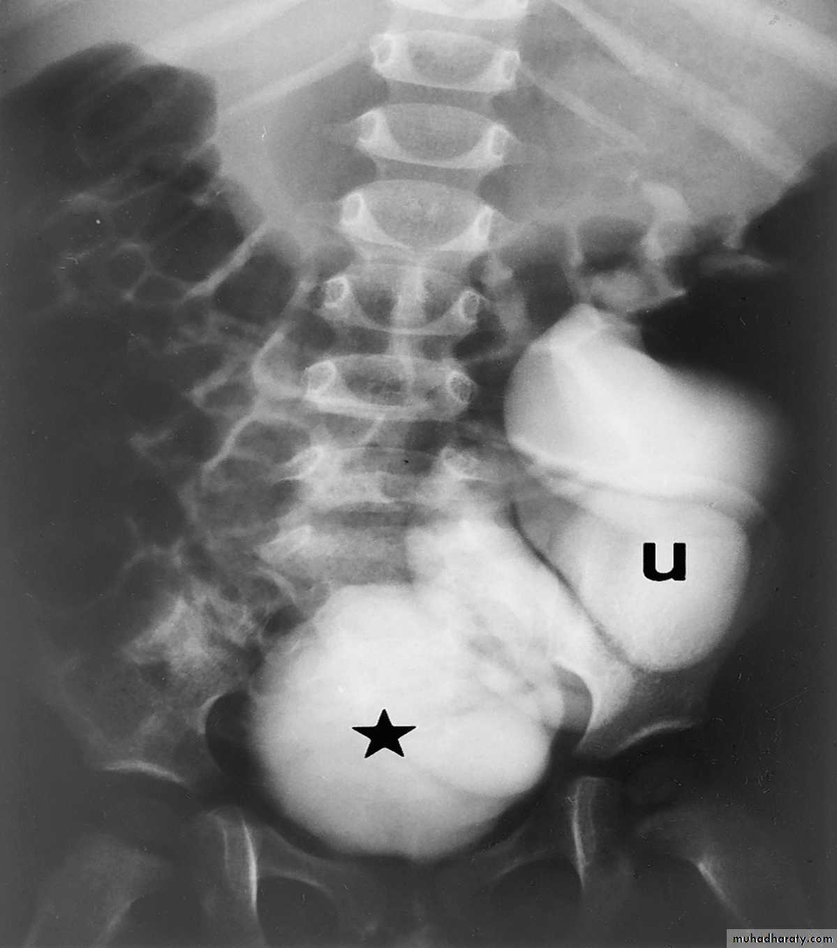 urinary tract imaging(films)