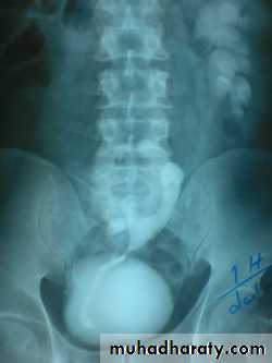 urinary tract imaging(films)
