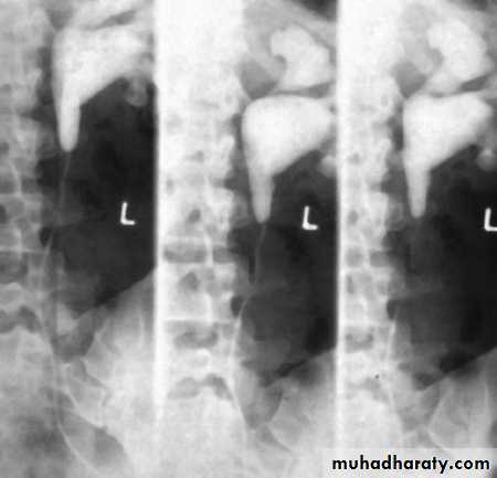 urinary tract imaging(films)