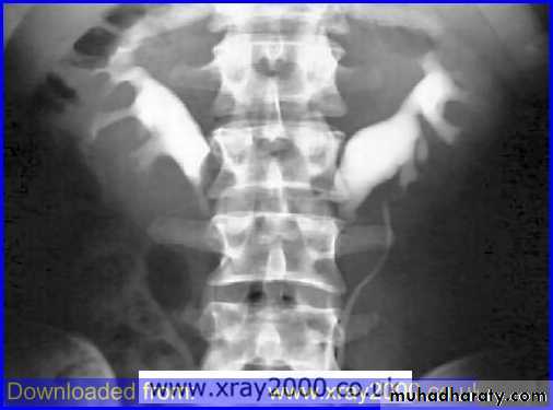 urinary tract imaging(films)