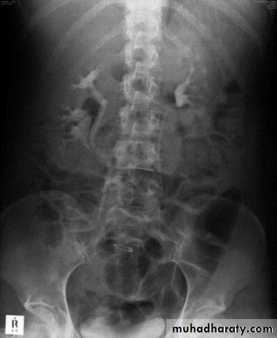 urinary tract imaging(films)