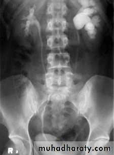 urinary tract imaging(films)
