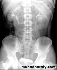 urinary tract imaging(films)