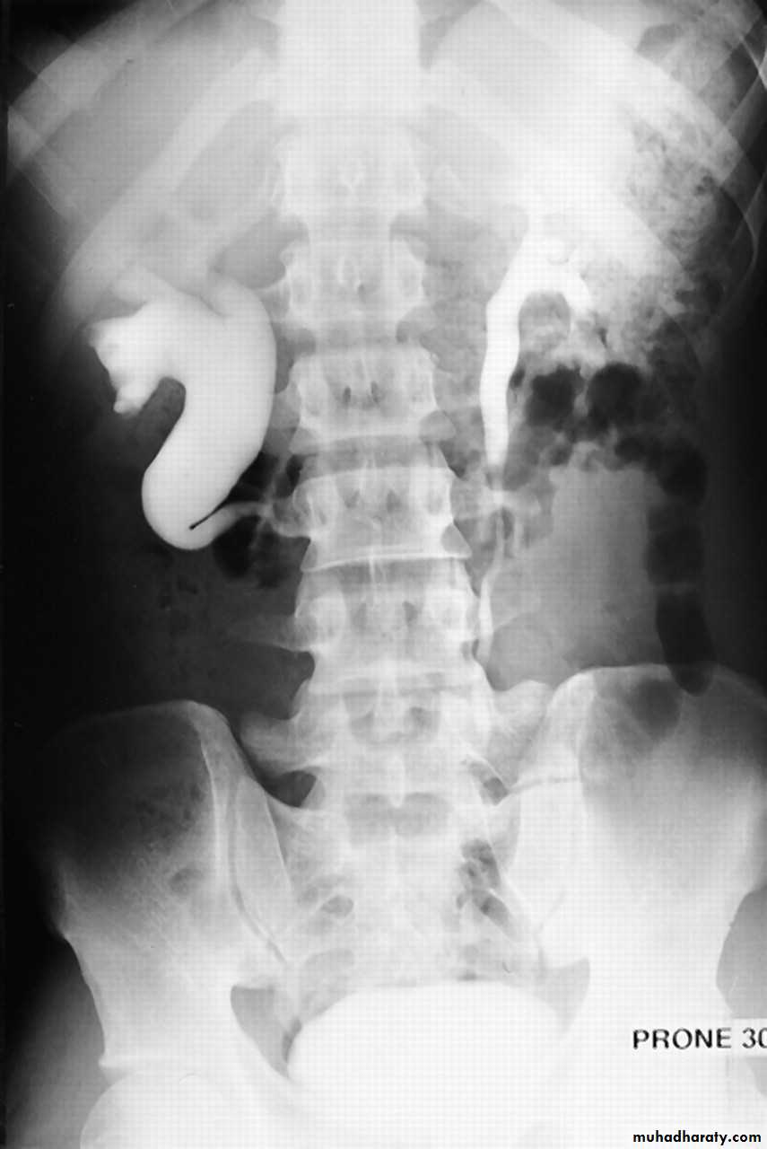 urinary tract imaging(films)