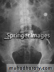 urinary tract imaging(films)