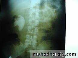 urinary tract imaging(films)