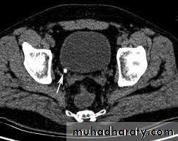 urinary tract imaging(films)