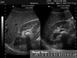 urinary tract imaging(films)