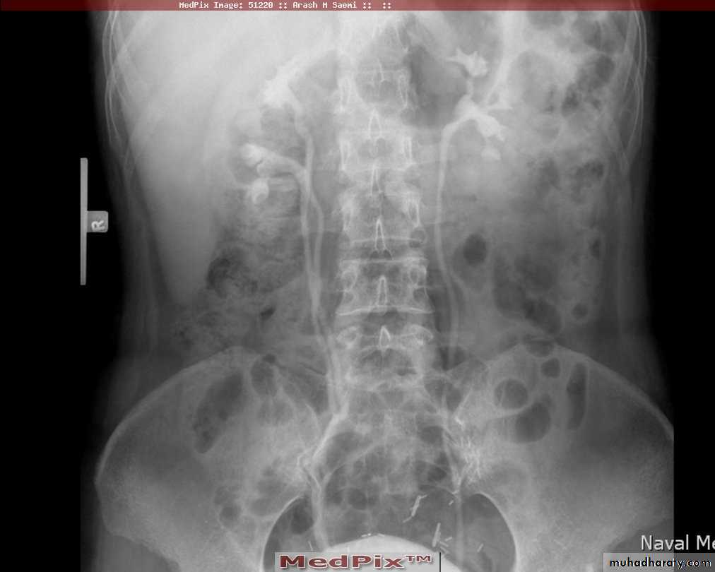 urinary tract imaging(films)