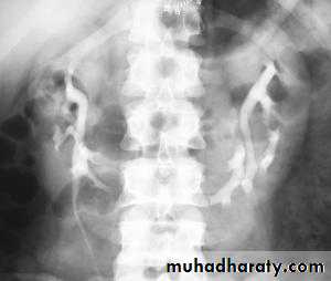 urinary tract imaging(films)