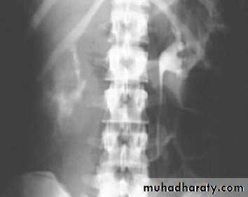urinary tract imaging(films)