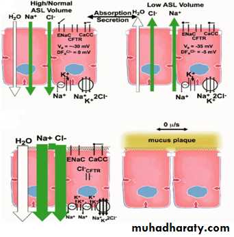 coaeliac diseas