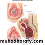 Amenorrhea
