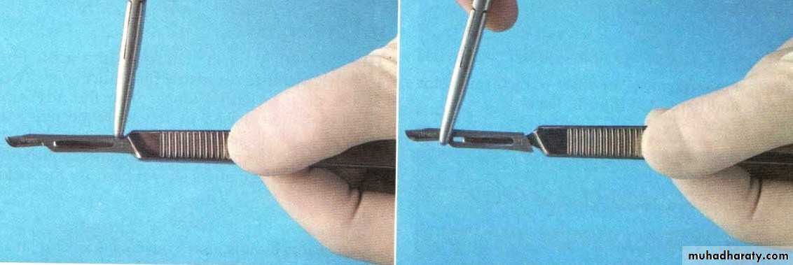 Surgery basics
