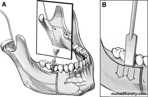 Surgery basics