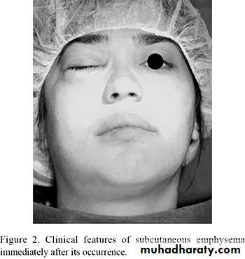 Surgery basics