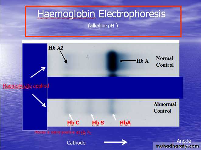 HEMOLYTIC DESORDERS