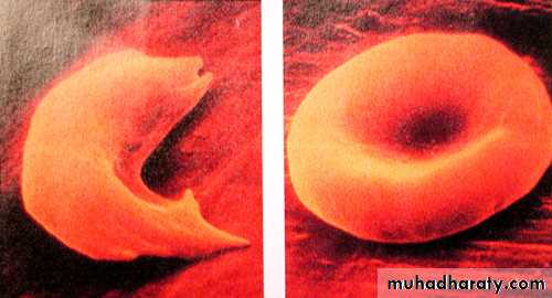 HEMOLYTIC DESORDERS