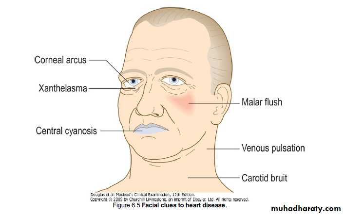 history taking in congenital heart disease