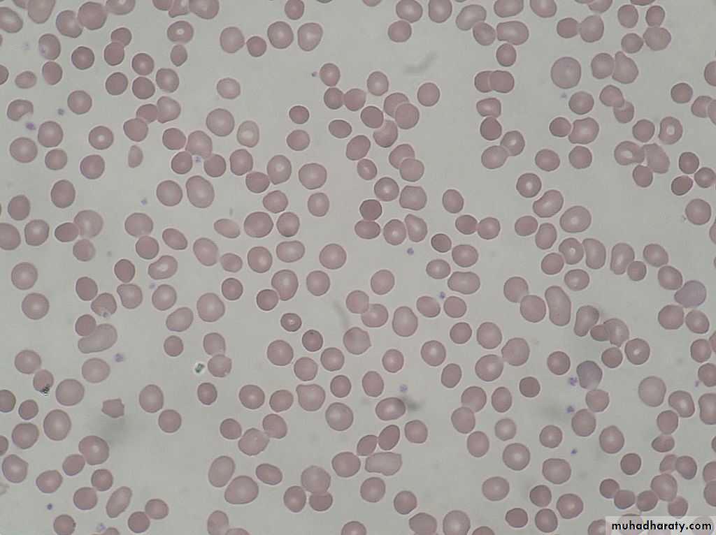 Hematology