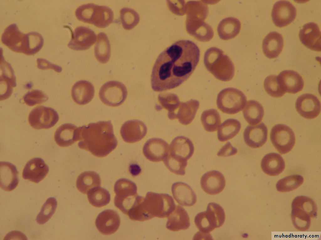 Hematology