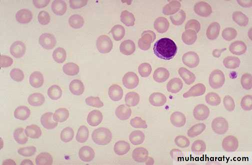 Hematology