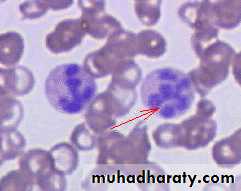 Hematology