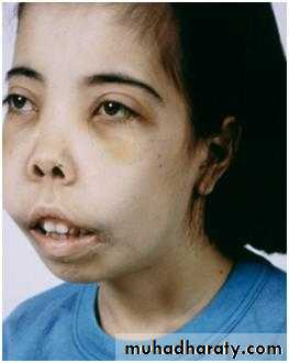 Hematology