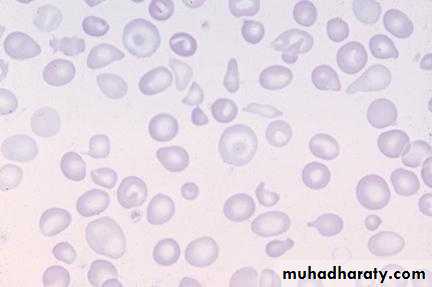 Hematology