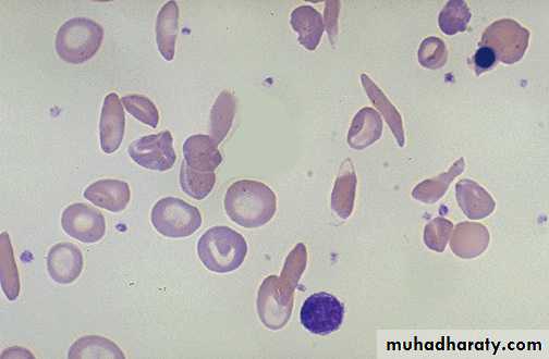 Hematology