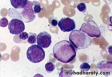 ACUTE LEUKEMIA