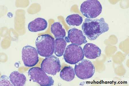 ACUTE LEUKEMIA