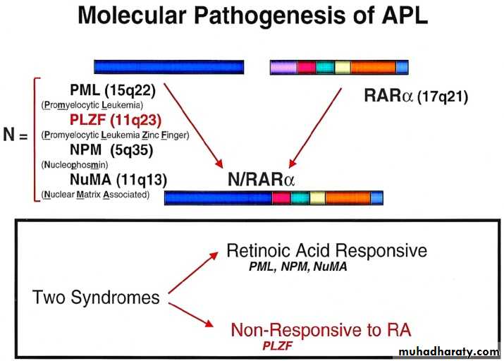 ACUTE LEUKEMIA