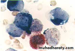 ACUTE LEUKEMIA