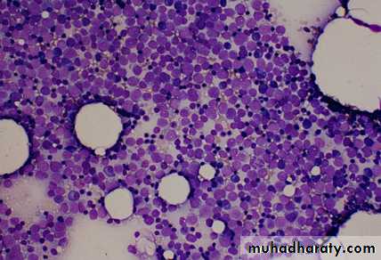 ACUTE LEUKEMIA
