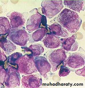 ACUTE LEUKEMIA