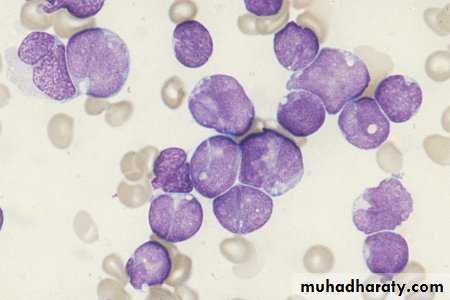 ACUTE LEUKEMIA