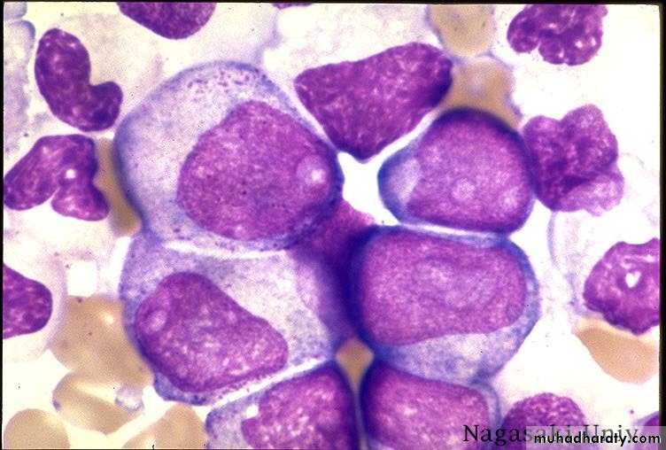 ACUTE LEUKEMIA