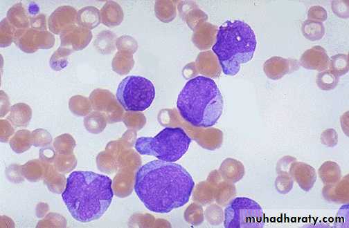 ACUTE LEUKEMIA