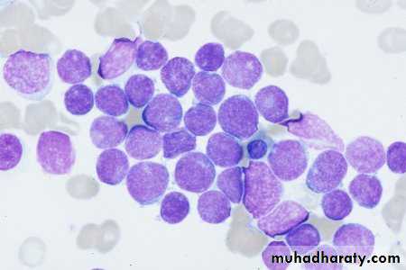 ACUTE LEUKEMIA
